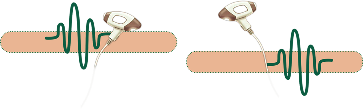 صورة العروض